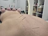 Лечебный массаж / Иглорефлексотерапия/Лфк - photo 1